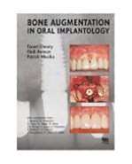 Bone Augmentation in Oral Implantology, (1850971595), Fouad Khoury 