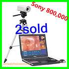 2012 Newest Digital Video Sony 800,000 Electronic Colposcope RCS 400