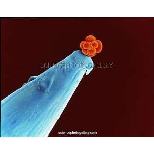  16 cell human embryo on a pin, SEM Framed Prints