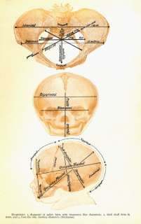 Vintage Newborn Fetal Skull Landmarks Chart Poster  